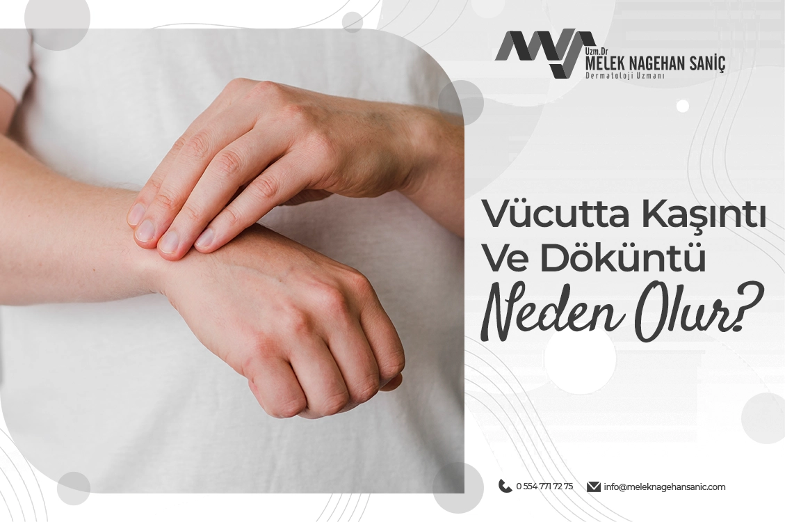 Vücutta Kaşıntı Ve Döküntü Neden Olur?