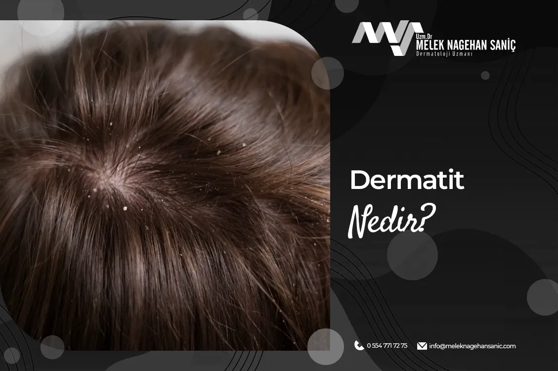 Dermatit Nedir?