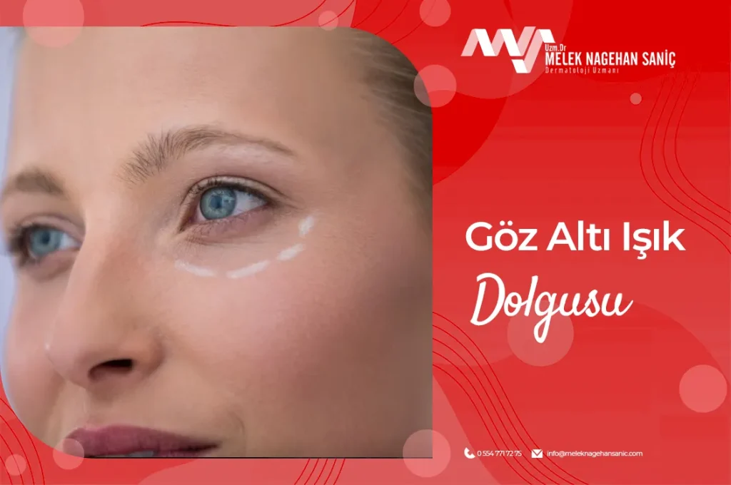 Göz Altı Işık Dolgusu