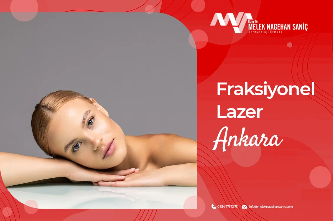 Fraksiyonel Lazer Ankara