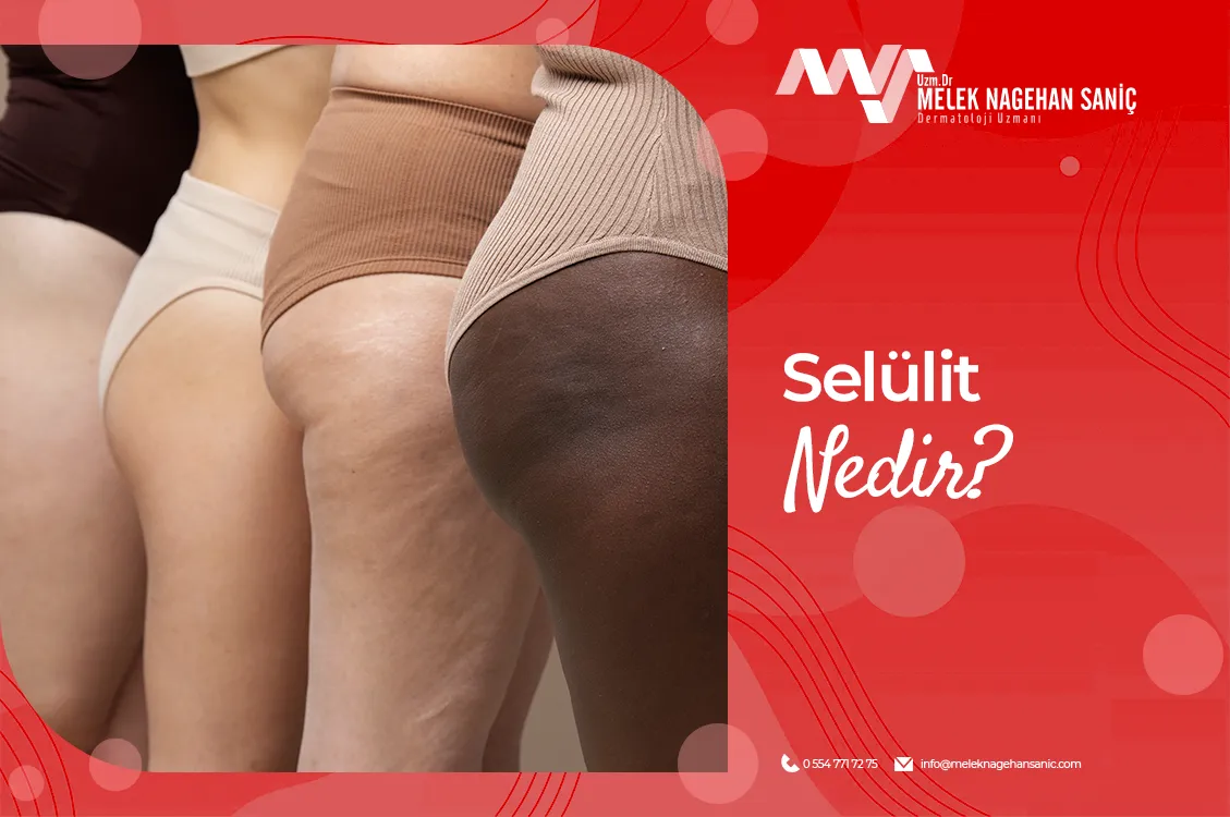 Selülit Nedir?