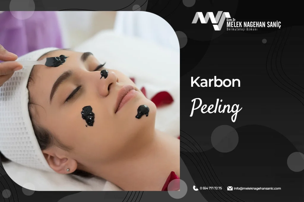 Karbon Peeling