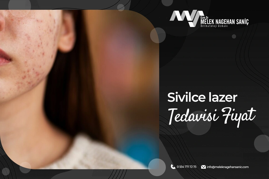 Sivilce Lazer Tedavisi Fiyat