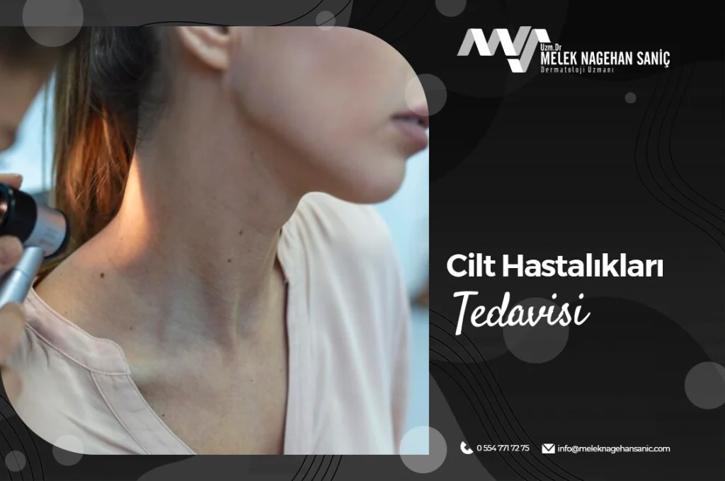 Cilt Hastalıkları Tedavisi