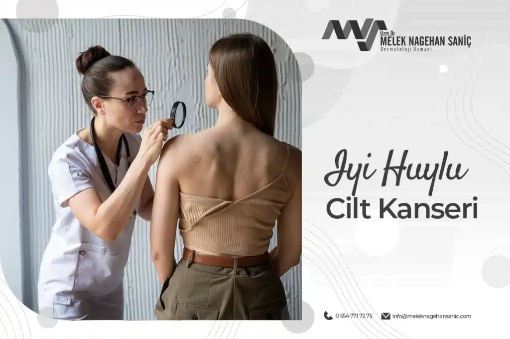 İyi Huylu Cilt Kanseri