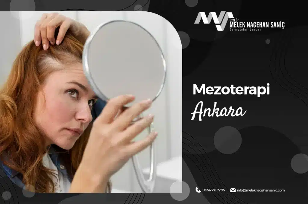 Mezoterapi Ankara