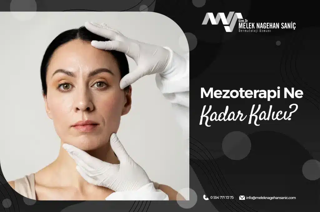 Mezoterapi Ne Kadar Kalıcı?